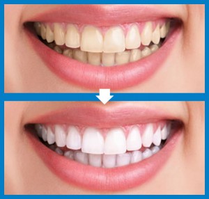 estètica dental, estética dental