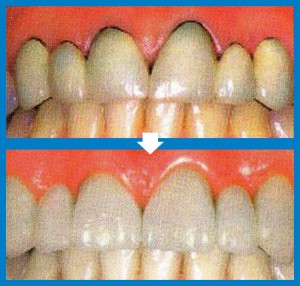estètica dental